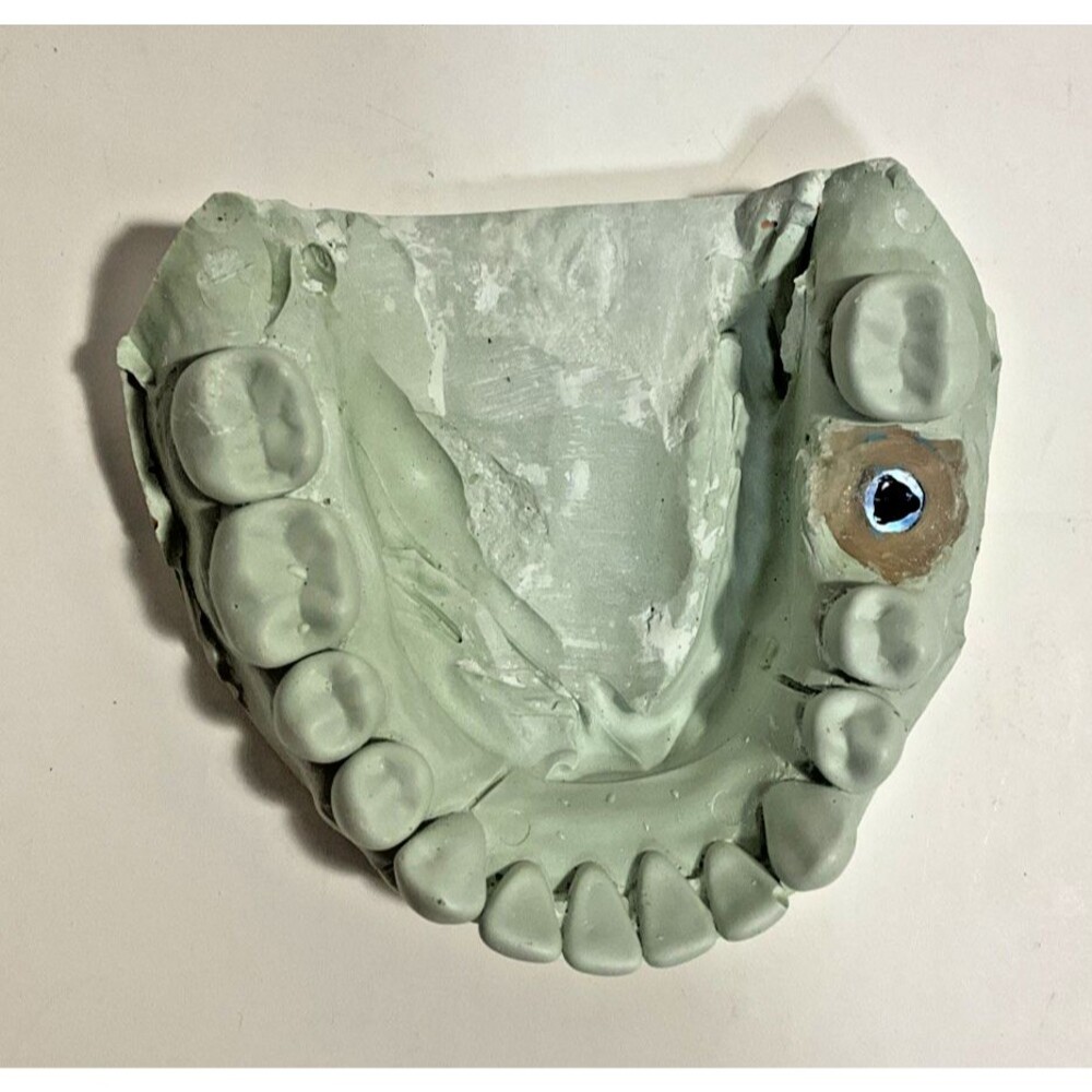 Dental Implant Stone Model Nobel Art